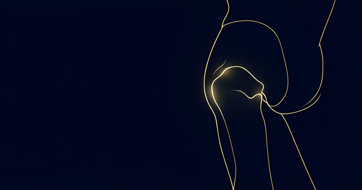 Borsite trocanterica: il dolore sul lato dell'anca che non lascia dormire